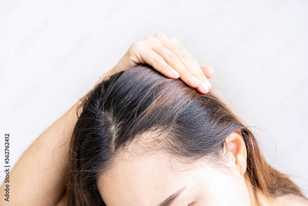 Fototapeta premium Young asian women worried about hair loss problems, Hiar care concept