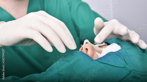 The surgeon put silicone on the nose. To measure before surgery