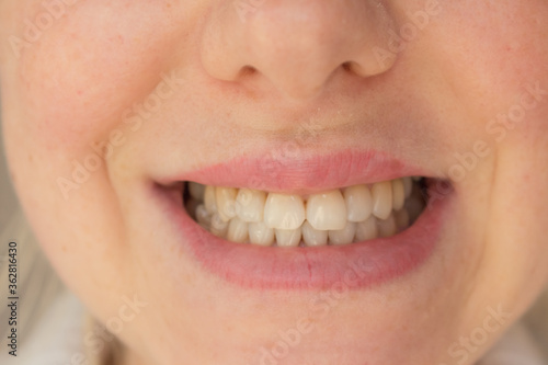  natural shade teeth, natural healthy teeth close-up. female smile