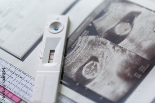  positive pregancy test with ultrasound photo