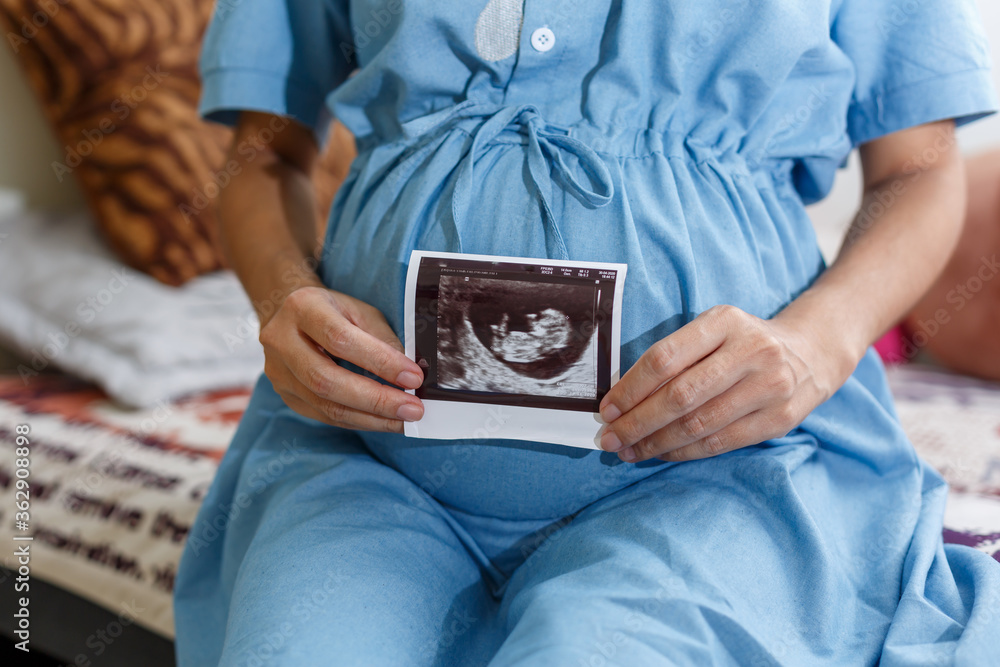 Pregnant woman holds ultrasound photo on the belly Pregnant woman holds ultrasound photo on the belly