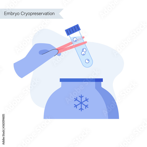 Reproductive system concept