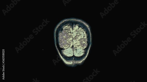 Bulk multicolored MRI brain, head scans and tumor detection. Diagnostic medical tool