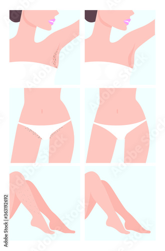 Set with the image of a girl on body care, depilation procedure before and after hair removal