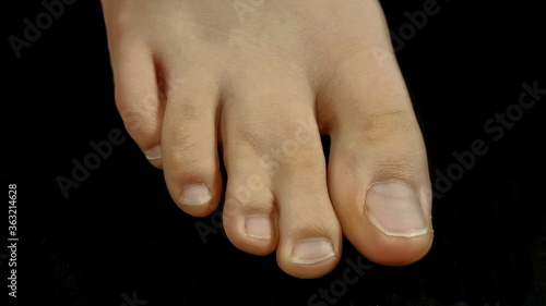 Cuadro en lienzo webbed digits
