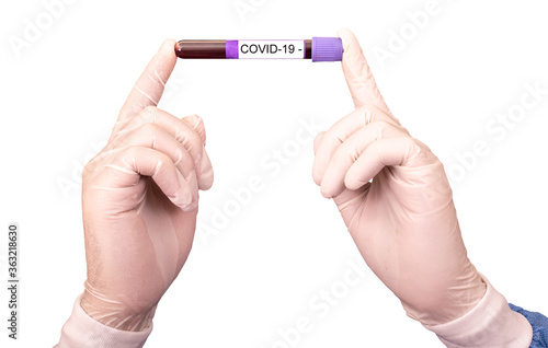 Scientist doctor in disposable gloves holds the tube with blood test of pacient. Testing negative to covid-19, global coronavirus pandemic 2020