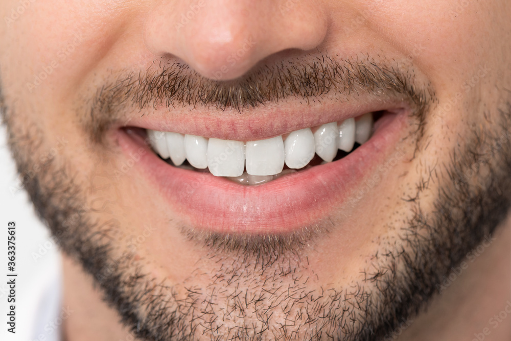 Fototapeta premium Teeth whitening, perfect smile