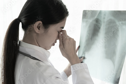 Doctor sad shocked after examined x-ray film lung of patient