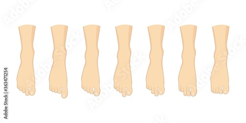 Foot toe shape types set.