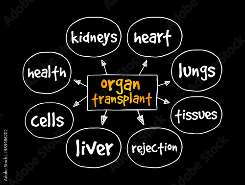 Organ Transplant mind map, medical concept for presentations and reports