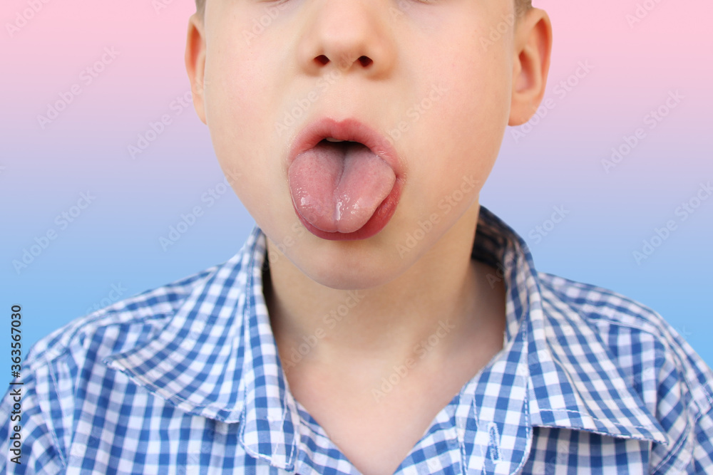 boy, kid performs articulation exercises for the development of the speech apparatus, close-up tongue, concept of speech disorders, methods for their correction, methods exercises boy, kid performs articulation exercises for the development of the speech apparatus, close-up tongue, concept of speech disorders, methods for their correction, methods exercises