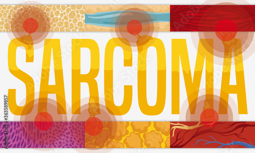 Design with Different Type of Tissues Affected by Sarcoma, Vector Illustration