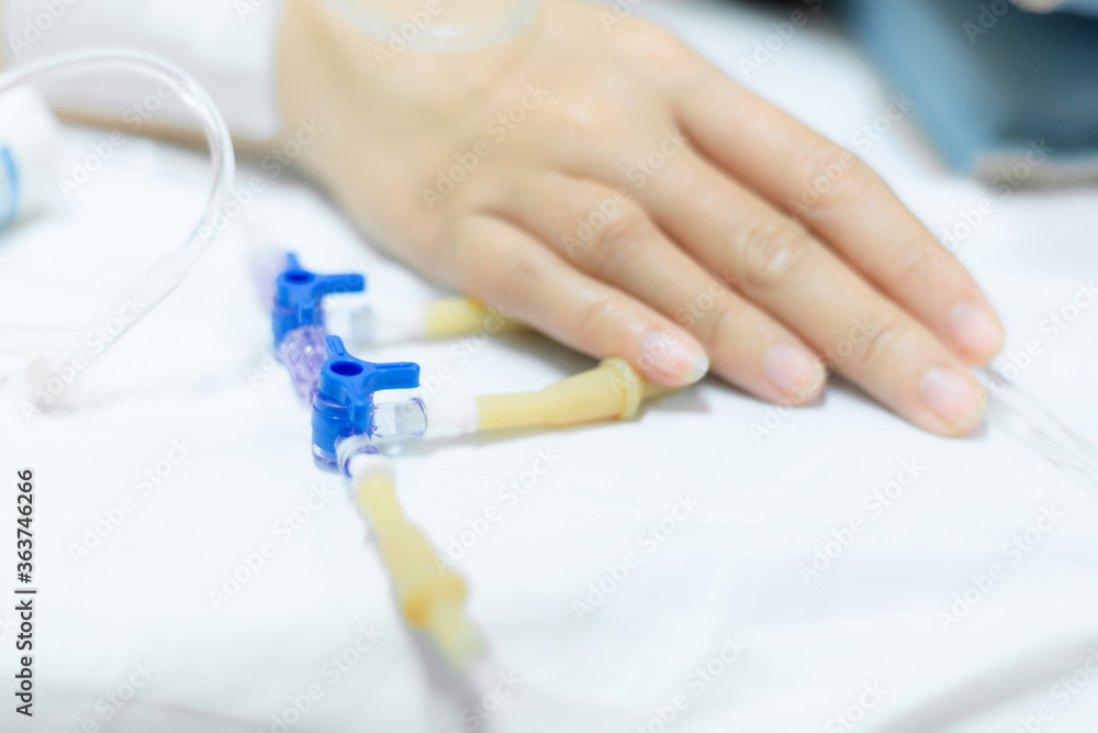 Close up of a woman patient in hospital with saline intravenous Close up of a woman patient in hospital with saline intravenous
