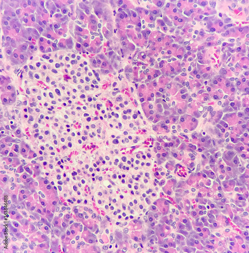 Photo of islets of langerhans (left side) in pancreatic tissue, magnification 400x