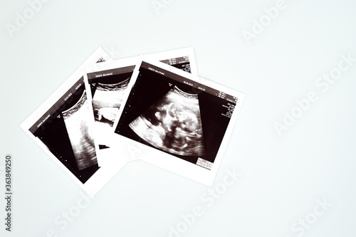 Result of ultrasound picture or ultrasonography for pregnancy on top of white isolated background