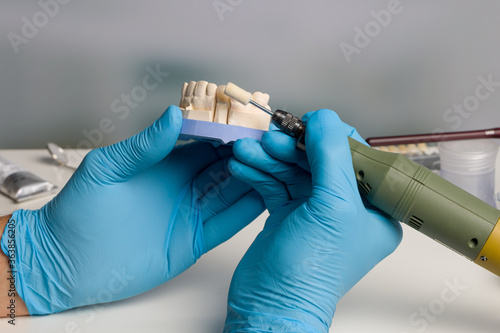 close up of detail working on denture parts with an electrical tool in a dental laboratory