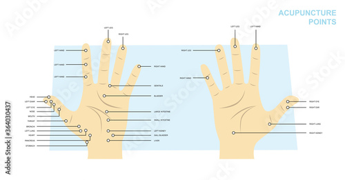 Acupuncture points Hands Manga Cartoon Vector Illustration