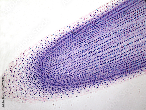 Microphotography of root mitosis of an onion.
