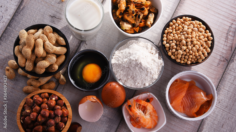 Fototapeta premium Composition with common food allergens