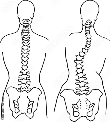 Contour vector outline drawing of human spine skeleton. Medical design editable template