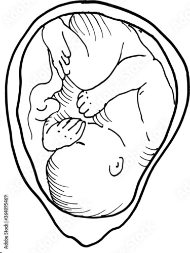 Contour vector outline drawing of human embryo. Medical design editable template