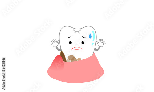 歯周ポケットに歯垢や汚れがついて虫歯に進行しそうな歯