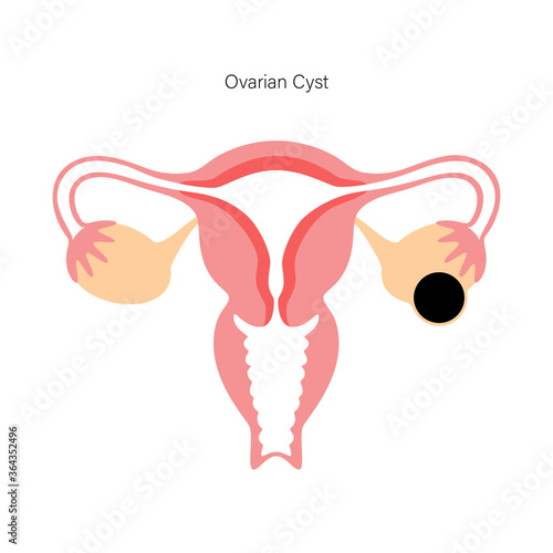 Reproductive system concept