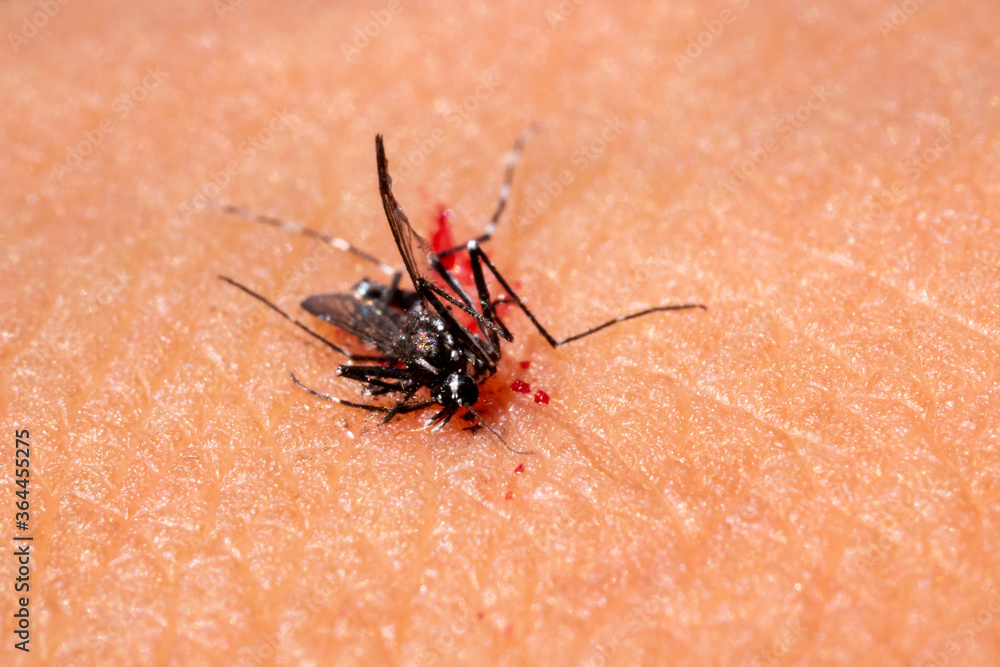 Mosquito dangerous villain destroys lives.Macro of killed mosquito with blood on the human skin Mosquito dangerous villain destroys lives.Macro of killed mosquito with blood on the human skin