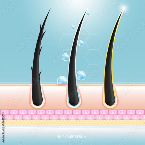 Hair care serum follicle diagnostics. Anatomy skin, medical human, epidermis layer, vector illustration design.