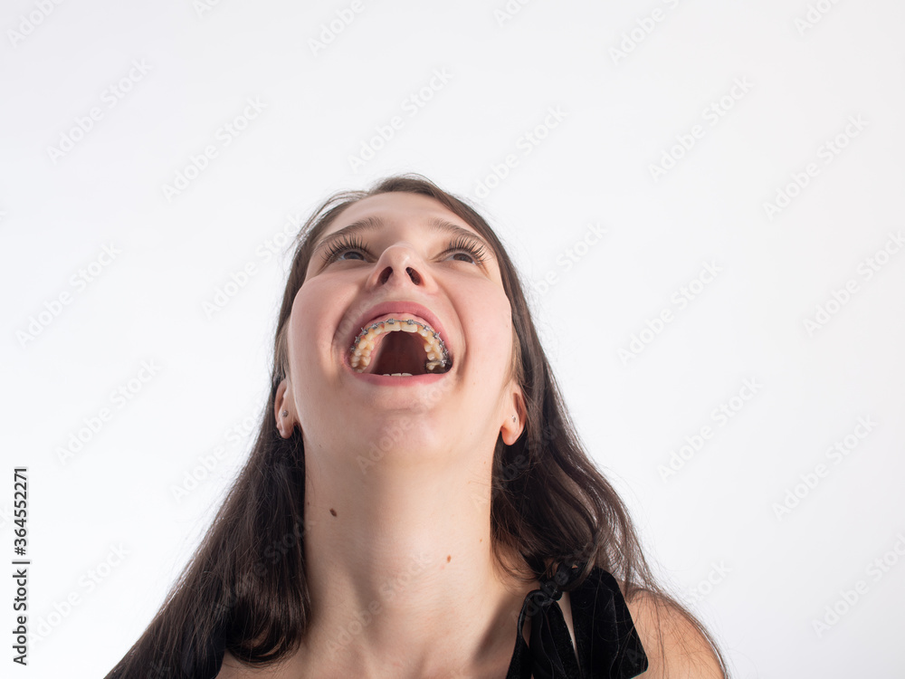 Portrait of a young black-haired girl with braces on her teeth on a white background. the girl is happy and laughing isolate on a white background. space for text. Portrait of a young black-haired girl with braces on her teeth on a white background. the girl is happy and laughing isolate on a white background. space for text.