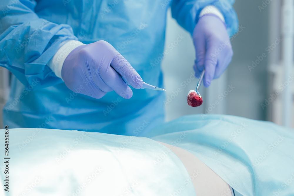 Everything necessary for the operation on stomach Everything necessary for the operation on stomach