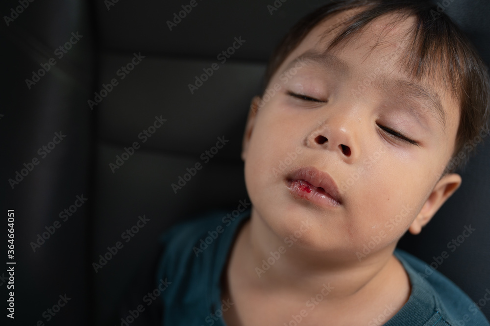Little boy Bleeding at the mouth Little boy Bleeding at the mouth