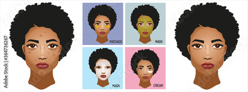 Young african americ.Treatment beauty. Problems on the skin pimples and acne, and dark circles under the eyes. Types of cosmetics masks, patches under the eyes and cream. Vector realistic illustration