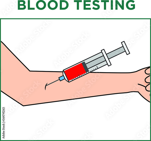 illustration of how blood sample is collected from human arm using a syringe