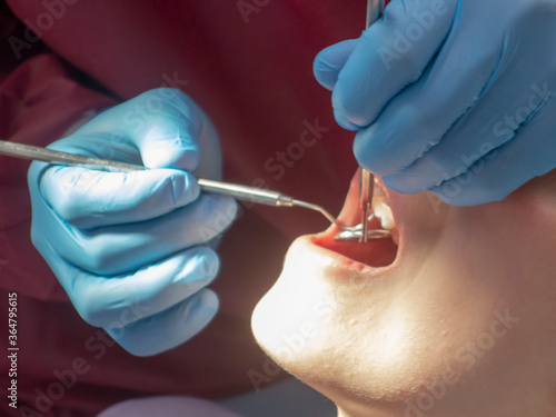 Operation with dental or dental hygienist patient. Woman with calculus or bruise. Oral Doctor wisdom tooth removal. Dentist. Expert business.