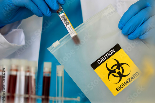 Lab professional putting vial into string bag with biohazard sign