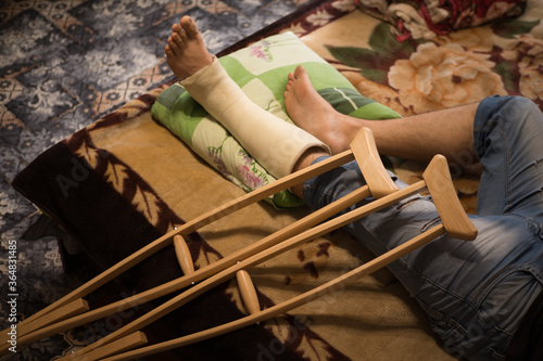 Obraz na płótnie Gypsum is imposed on the man’s leg and walking on crutches is prescribed, and bed rest, as he has a closed fracture of the fibula without displacement