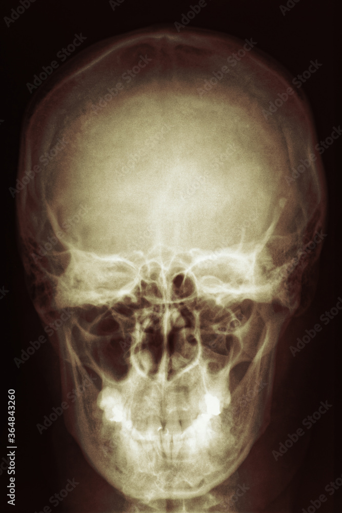X-ray skull image. Human head radiology scan. X-ray skull image. Human head radiology scan.