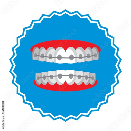 dental braces