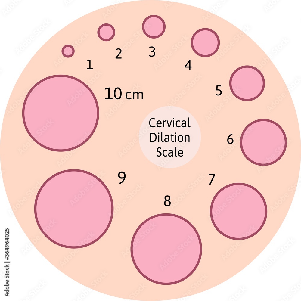 Cervix Dilation Chart Signs Stages And Procedure To Check 43 OFF