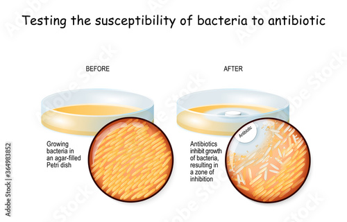 bacteria and antibiotic in a Petri dish.