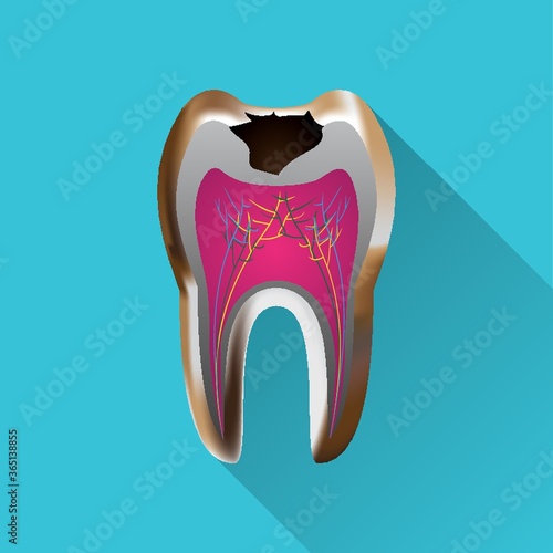 tooth with cavity