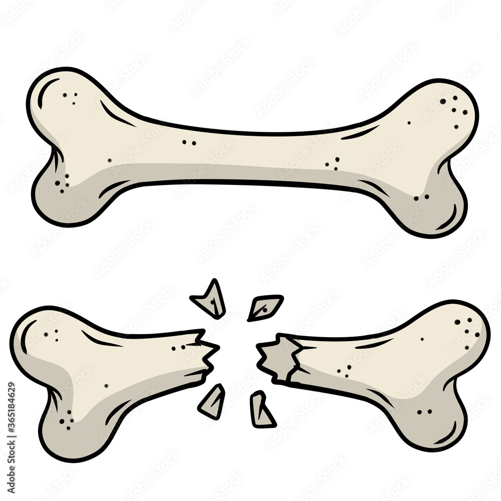 Fototapeta premium Bone fracture. Trauma to the body. Crack and splinters. Dangerous situation and wound. Cartoon flat illustration and dog toy isolated on white background