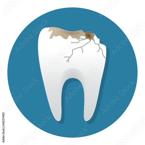 tooth cavity