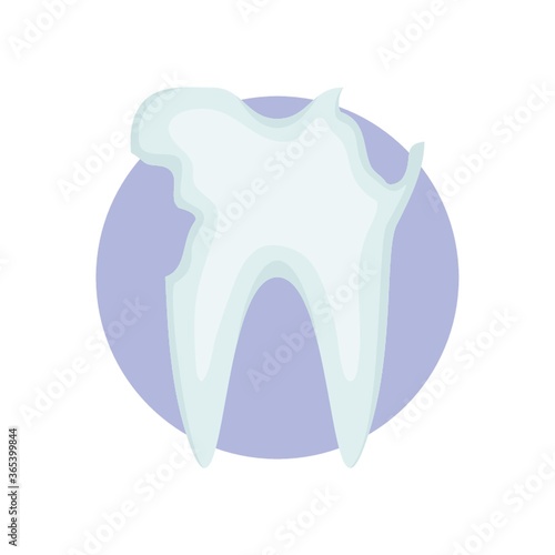 cavity in tooth