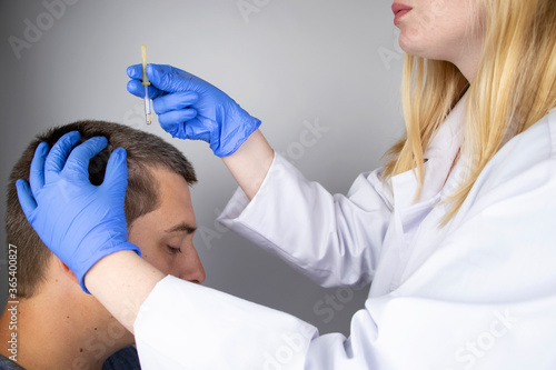 A trichologist doctor drips the serum onto the patient s hair. Treatment of alopecia. Hair loss  alopecia  pruritus  burning head or seborrhea