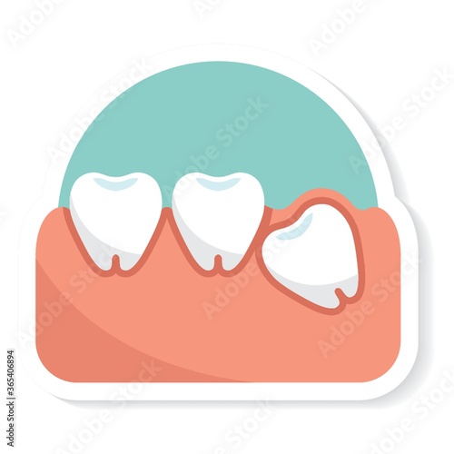 impacted tooth
