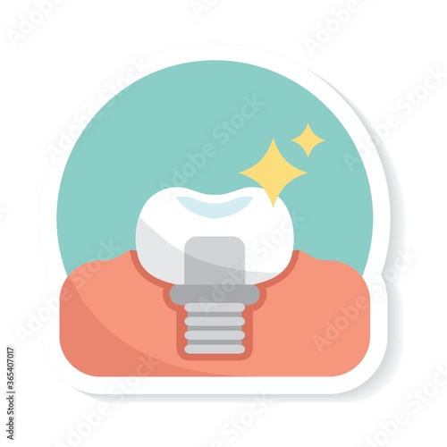 tooth implant