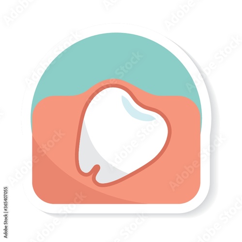 ingrown tooth