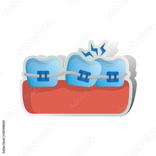 braces for fixing unaligned teeth
